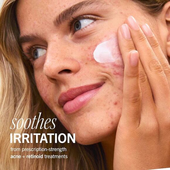 First Aid Beauty-Ultra Repair Rescue Skin Barrier Balm + Mask with Dimethicone - Picture 4 of 7